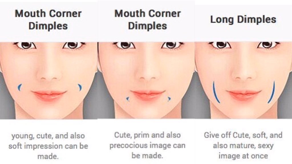 Types Of Dimples