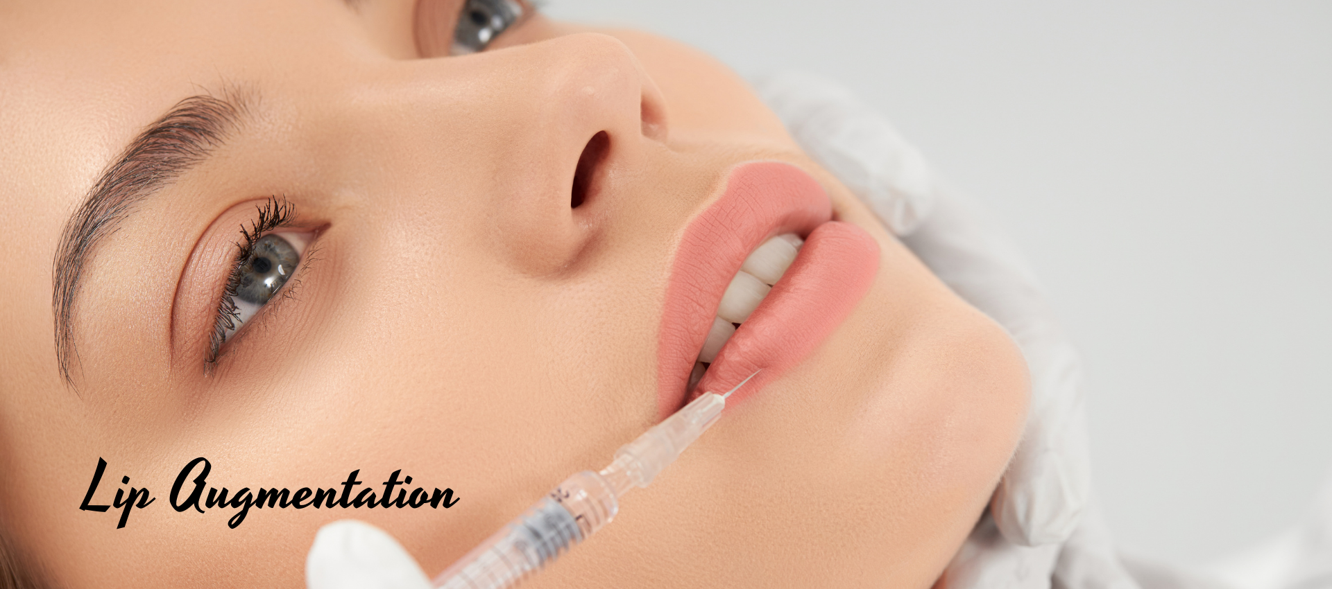 lip-augmentation